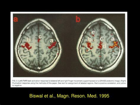 biswal et al. 1995